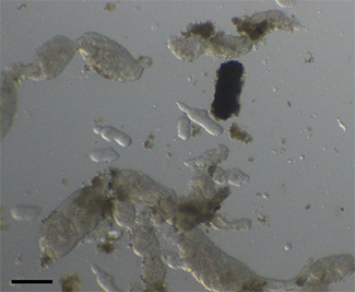 オオケマイマイから得られた槍形吸虫のスポロシスト　スケール：200 μm.