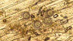 罹病組織中に形成された卵胞子