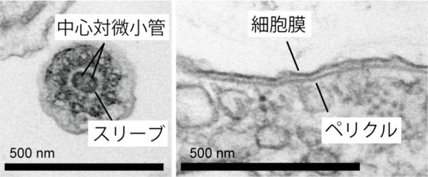 Glissandra oviformisの透過型電子顕微鏡写真