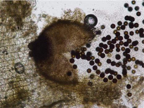 図4：子のう殻から放出された子のう胞子（提供：高知県病害虫防除所）