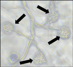 培地上に形成された 菌糸および小型分生子（写真提供：佐賀県農業技術防除センター病害虫防除部）