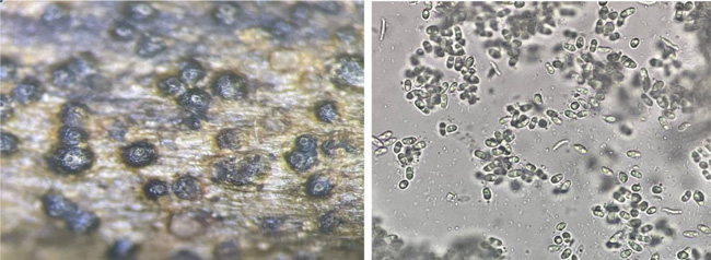 図３：茎に形成された小黒粒（柄子殻）・図４：症状部位から漏出する胞子（写真提供：佐賀県農業技術防除センター）