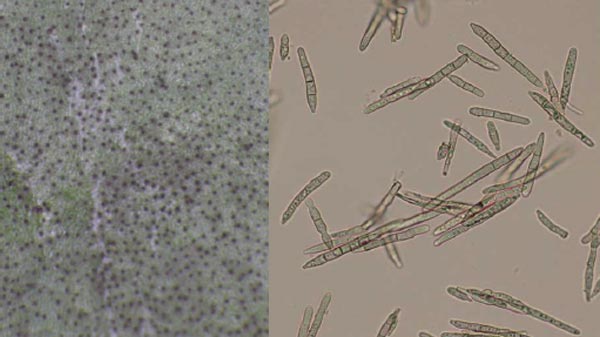 分生子座と分生胞子（写真提供：青森県病害虫防除所）