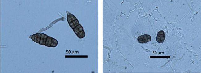 写真3：S. lycopersici の分生子、写真4：S. vesicarium の分生子