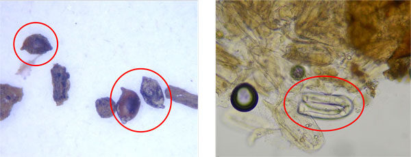 左から、写真1：シスト、写真2：シストから出てきた幼虫（提供：愛知県農業総合試験場）