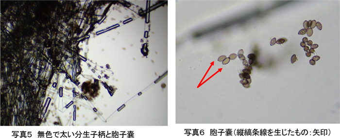 写真5：無色で太い分生子柄と胞子嚢、写真6：胞子嚢。縦縞条線を生じたもの（矢印）（提供：埼玉県病害虫防除所）