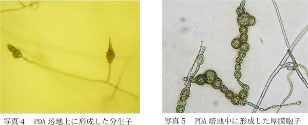 写真4：PDA培地上に形成した分生子と写真5：PDA培地中に形成した厚膜胞子（提供：愛知県農業総合試験場）