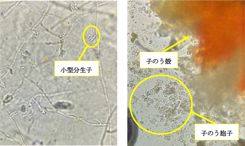 図4：小型分生子（写真提供：福岡県農林業総合試験場）、図5：子のう殻・子のう胞子（写真提供：福岡県農林業総合試験場）