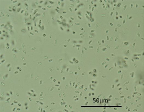 【特殊報】ショウガに「ショウガ紅色根茎腐敗病」県内で確認　熊本県2.jpg