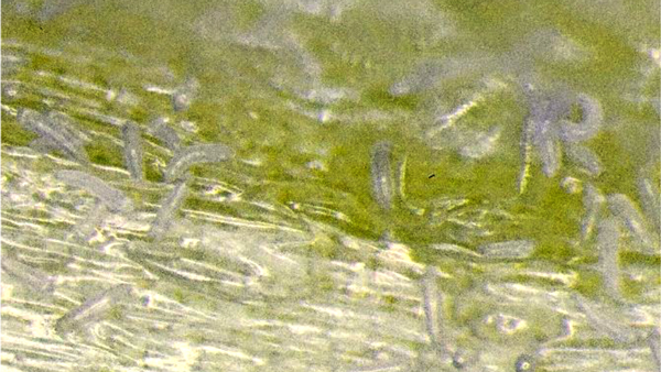 葉鞘部に寄生するフシダニ（写真提供：栃木県農業環境指導センター）