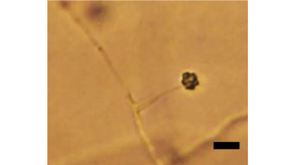 写真2：分離菌の形態的特徴（分生子柄と分生子）※スケールバー：10μm（提供：岡山県病害虫防除所）