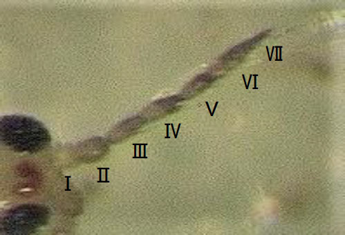 クロゲハナアザミウマの触覚（節以外は褐色～黒色）（写真提供：岩手県病害虫防除所）
