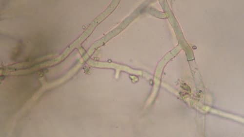 Rsolaniの菌糸（写真提供：宮城県病害虫防除所）