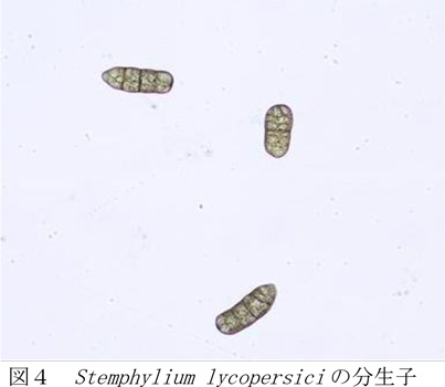図4：Stemphylium lycopersici の分生子（提供：宮崎県病害虫防除・肥料検査センター）