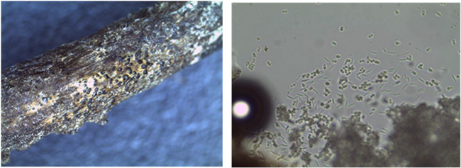 病変部の微小な黒粒（柄子殻）、図4：柄子殻の内部から噴出した胞子（写真提供：山口県県病害虫防除所）
