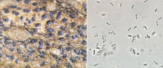 図2：茎に形成された小黒粒柄子殻、図3：発症部位から漏出した胞子