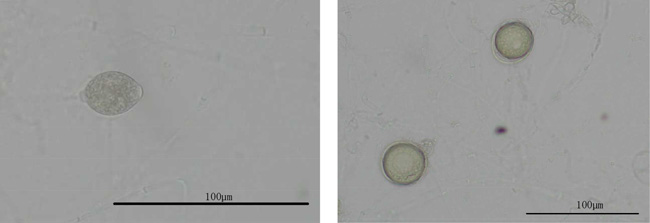 図3：V8培地上に形成された遊走子のう・図4： V8培地上に形成された卵胞子